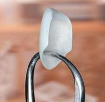A single porcelain veneer being held up by a dental tool.