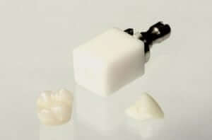 A block of porcelain used by a CEREC machine for crowns