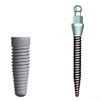 A full-sized dental implant side by side with a mini dental implant