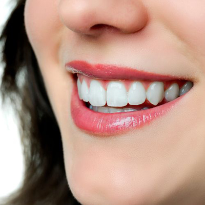 Close-up smile, for information on gum disease therapy with Perio-360 from Kalamazoo dentist Dr. Susan Dennis